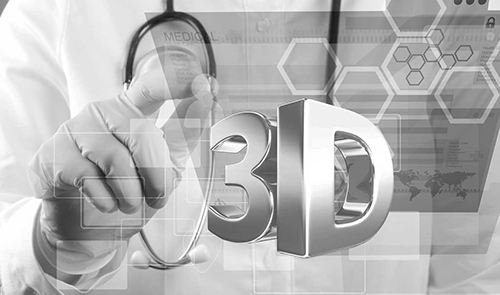 ���R���F(tu��n)3D��ӡ���㲿�����_(d��)���f ���®a(ch��n)Ʒ���ڌ��Ri8��܇