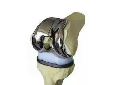 �ɹ��^�����e�����P���ÓQ�����u�������tԺ�ɹ��_չ�˹��մ������g