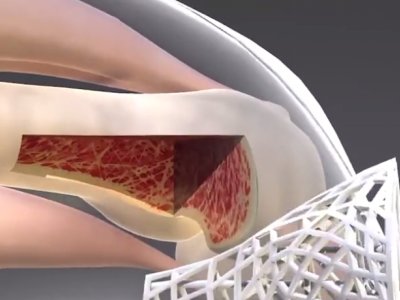 �ɲ��T�������t�ò��τ��¾۽��߷��Ӳ��ϡ����ٲ��ϡ��o�C�ǽ��ٲ����������c����