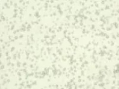 ������X���²��Ϲ���(y��ng)�̣��m��h���µV�I(y��)�Ƽ����v����ͨ