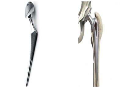 ���h(hu��n)����TC-BIO�մ��y�P(gu��n)��(ji��)�����ɹ�ͨ�^(gu��)���ęn��ӛ